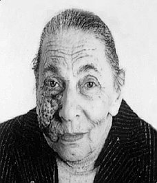 Forcella Antonietta Teresa
