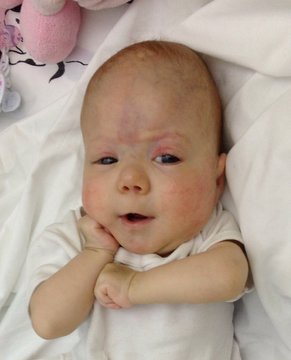 Visini Camilla (6 Mesi)